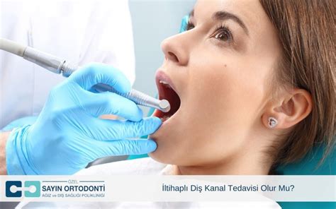 Iltihaplı Diş Kanal Tedavisi Olur Mu?